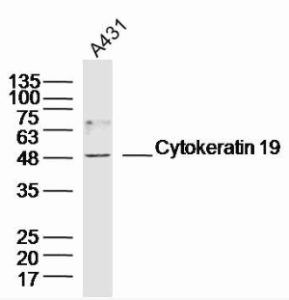 细胞角蛋白19片段图片