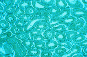 非洲绿猴肾细胞形态